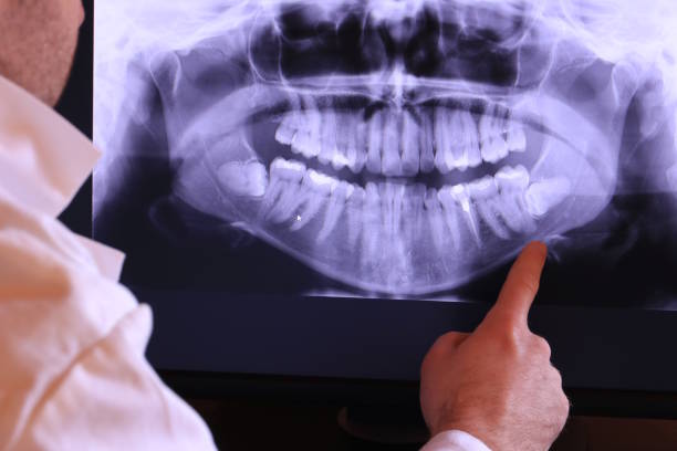 Best Emergency Tooth Extraction in Ardmore, OK
